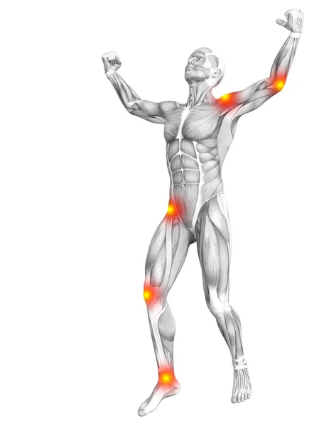 Konzeptionelle menschliche Muskelanatomie mit rot-gelben Hotspot-Entzündungen oder Gelenkschmerzen für die Gesundheitstherapie oder Sportkonzepte. 3D Illustration Mann Arthritis oder Knochen-Osteoporose-Erkrankung — Stockfoto