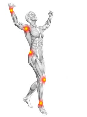 Kırmızı ve sarı sıcak nokta iltihap veya parçalanmõ * eklem ağrısı sağlık tedavi veya spor kavramlar kavramsal insan kas anatomisi. 3D çizim adam artrit veya kemik Osteoporoz hastalığı