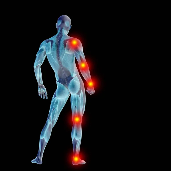 Korkean resoluution käsite käsitteellinen 3D ihmisen anatomian elin, jossa kipu eristetty mustalla pohjalla metaforana terveydelle, lääketieteelle, lääketieteelle, biologialle, osteoporoosille, niveltulehdukselle, nivelelle, tulehduskivulle — kuvapankkivalokuva