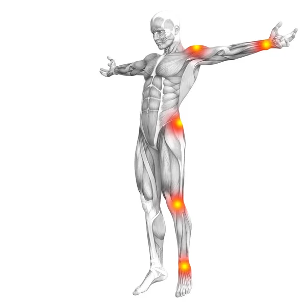 Anatomía muscular humana conceptual con inflamación del punto caliente rojo y amarillo o dolor articular articular para la terapia de atención médica o conceptos deportivos. Ilustración 3D hombre artritis u osteoporosis ósea enfermedad —  Fotos de Stock