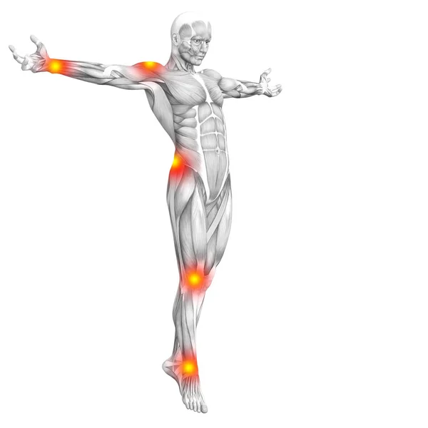 Концептуальная анатомия мышц человека с воспалением красной и желтой горячих точек или суставной боли в суставах для терапии здравоохранения или спортивных концепций. 3D иллюстрация человека артрит или болезнь костного остеопороза — стоковое фото