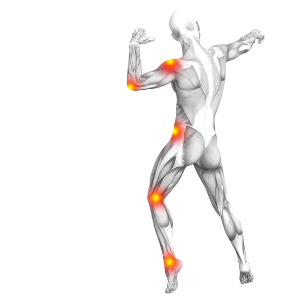 Koncepcyjne ludzkich mięśni Anatomia z zapalenie czerwone i żółte hot spot lub stawowej stawów dla opieki zdrowotnej terapii lub koncepcji sportu. 3D ilustracja mężczyzna zapalenie stawów lub kości osteoporoza choroby — Zdjęcie stockowe