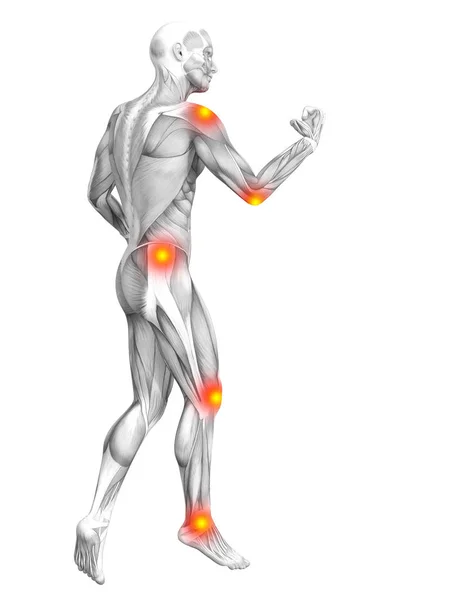 빨간색과 노란색 핫 스팟 염증 또는 관절 관절 통 스포츠 개념 또는 의료 치료에 대 한 개념적 인간의 근육 해부학. 3d 그림 남자 관절염 이나 뼈 골다공증 질환 — 스톡 사진