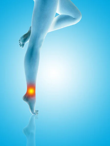 Ilustración conceptual del dolor en las piernas — Foto de Stock