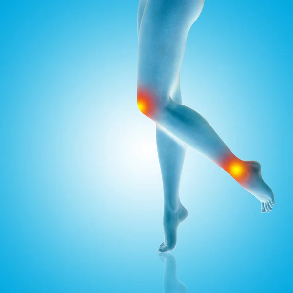 Conceptual illustration of leg ache — Stock Photo, Image