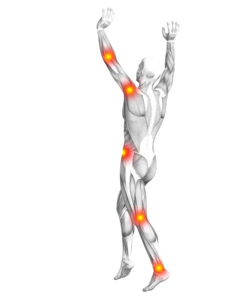Muskel-Anatomie mit roten Flecken — Stockfoto