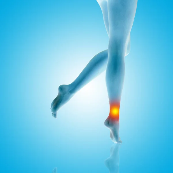 Ilustración conceptual del dolor en las piernas — Foto de Stock