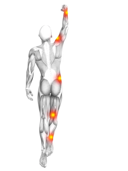 Ilustración conceptual del dolor en las piernas —  Fotos de Stock