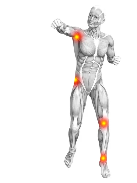 Konzeptionelle menschliche Muskelanatomie mit rot-gelben Hotspot-Entzündungen oder Gelenkschmerzen für die Gesundheitstherapie oder Sportkonzepte. 3D Illustration Mann Arthritis oder Knochen-Osteoporose-Erkrankung — Stockfoto