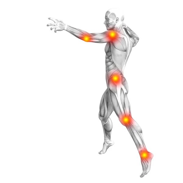 Konceptuella mänsklig muskel anatomi med röda och gula het fläck inflammation eller artikulära ledvärk för hälso-och terapi eller sport begrepp. 3D illustration man artrit eller ben osteoporos sjukdom — Stockfoto