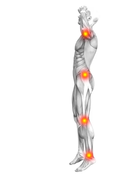 Conceptuele menselijke spier anatomie met rode en gele hotspot ontsteking of articulaire gewrichtspijn voor gezondheidszorg therapie of sport concepten. 3D Illustratie man artritis of bot osteoporose ziekte — Stockfoto