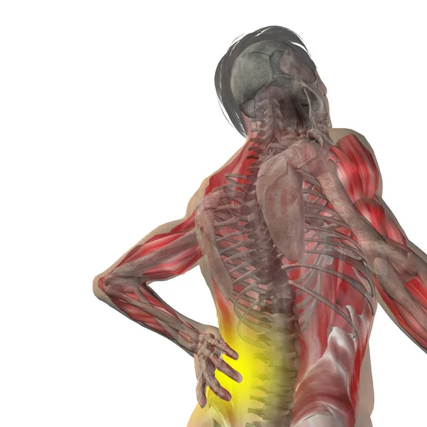 Adam anatomisi arka ağrı ile — Stok fotoğraf