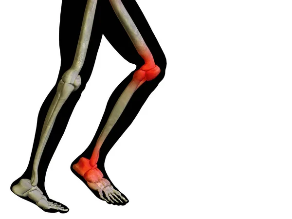 Joints  articular pain — Stock Photo, Image