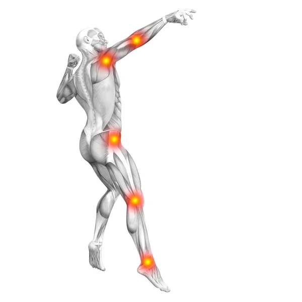 Anatomía Muscular Humana Conceptual Con Inflamación Del Punto Caliente Rojo —  Fotos de Stock