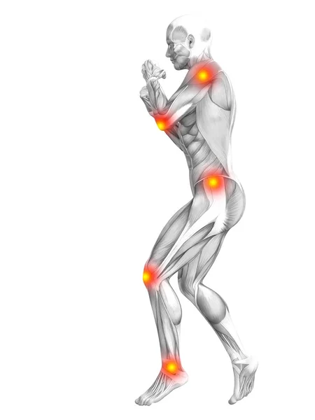 Conceptuele Menselijke Spier Anatomie Met Rode Gele Hotspot Ontsteking Osteoporose — Stockfoto