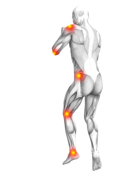Концептуальная Анатомия Мышц Человека Воспалением Красной Желтой Горячих Точек Остеопороз — стоковое фото