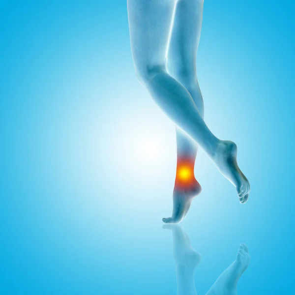 Conceptual beautiful female legs with hurt ankle pain, painful sport injury concept