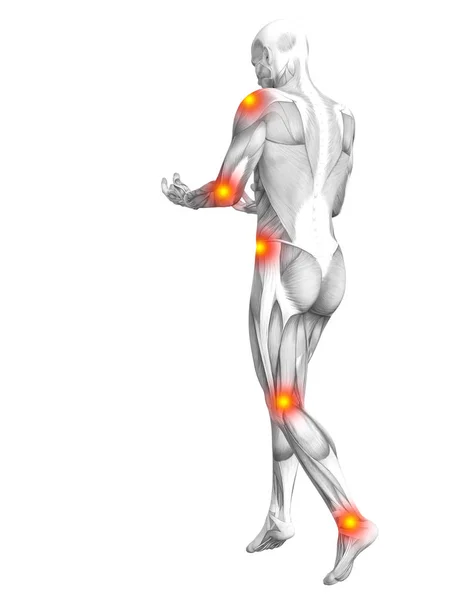 Anatomia Pojęciowy Ludzkich Mięśni Zapalenie Czerwone Żółte Hot Spot Osteoporoza — Zdjęcie stockowe