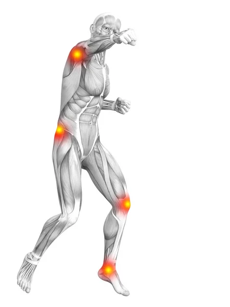 Conceptuele Menselijke Spier Anatomie Met Rode Gele Hotspot Ontsteking Osteoporose — Stockfoto