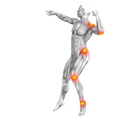 Conceptual human muscle anatomy with red and yellow hot spot inflammation, osteoporosis, sport concept   clipart