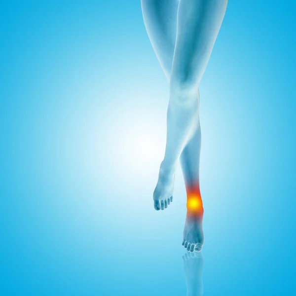 Conceptual beautiful female legs with hurt ankle pain, painful sport injury concept