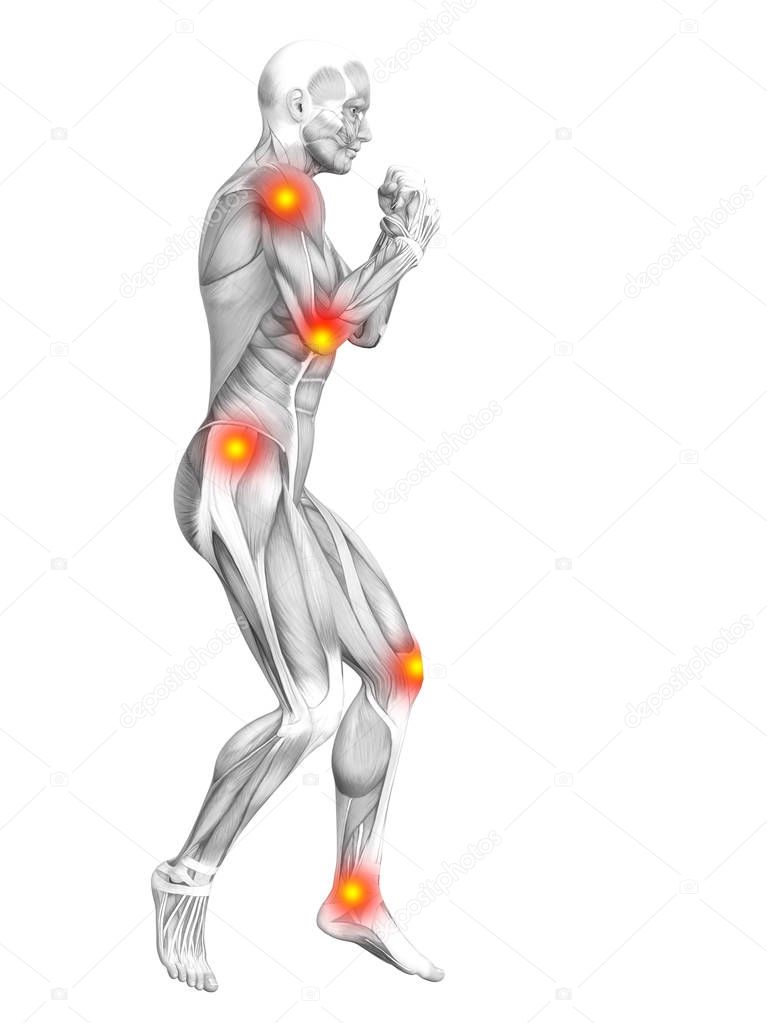 Conceptual human muscle anatomy with red and yellow hot spot inflammation, osteoporosis, sport concept  