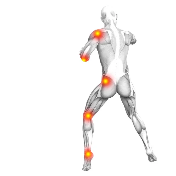Anatomia Pojęciowy Ludzkich Mięśni Zapalenie Czerwone Żółte Hot Spot Osteoporoza — Zdjęcie stockowe