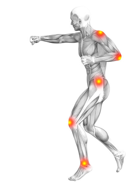 Концептуальная анатомия мышц человека с воспалением красной и желтой горячих точек, остеопороз, спортивная концепция
  