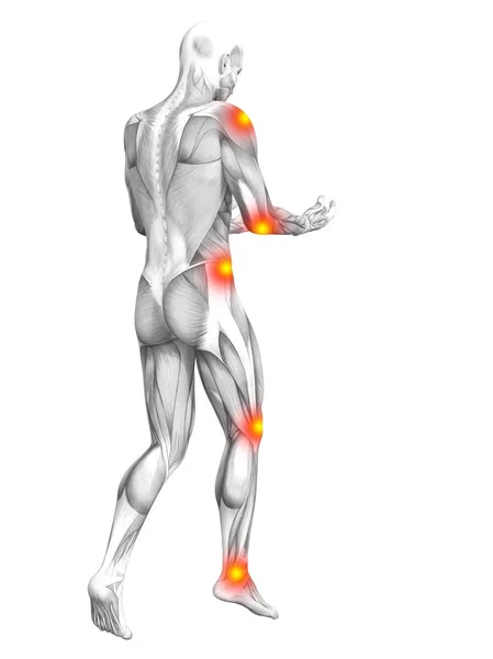 Conceptual Human Muscle Anatomy Red Yellow Hot Spot Inflammation Osteoporosis — Stock Photo, Image