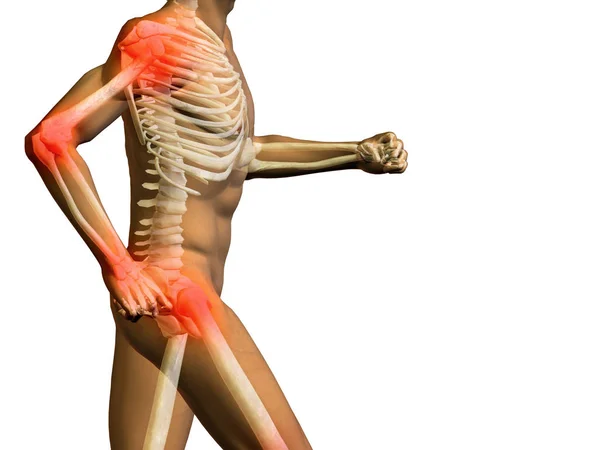 Man Anatomy Illustration Pain — Stock Photo, Image