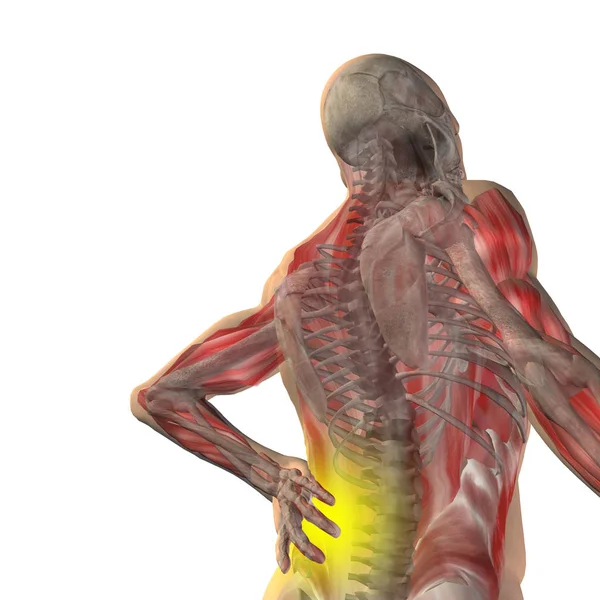 Anatomie des Mannes mit Rückenschmerzen — Stockfoto