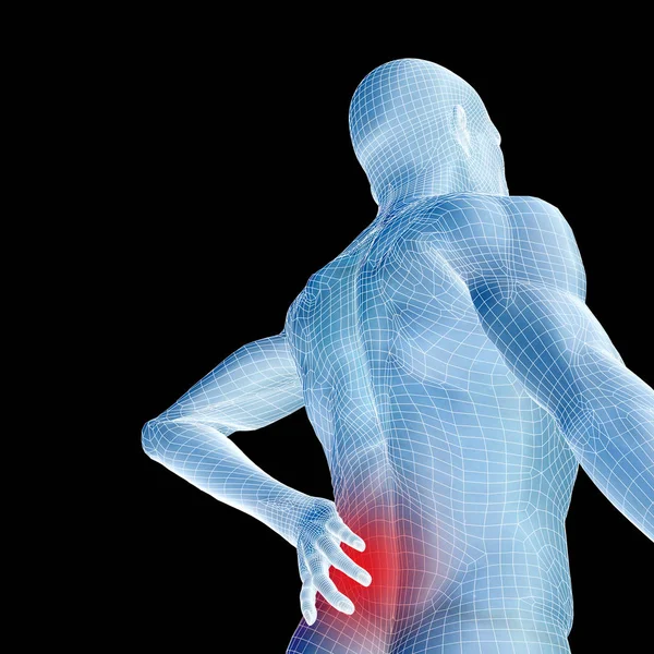 Yüksek çözünürlüklü kavram ya da ağrı, sırt, vücut, omurga, sırt ağrısı, tıp, yaralanma, tıp, sağlık, zarar, ağrılı, omurga tedavisi için metafor olarak siyah arka plan üzerine izole kavramsal 3d insan erkek ya da insan anatomisi — Stok fotoğraf