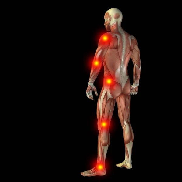 Articular or bones pain — Stock Photo, Image