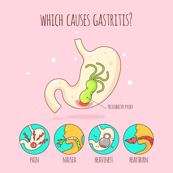 人間の胃とピロリ菌は、胃の痛み、胃潰瘍。プラカード、ポスター。フラットのベクトル図 — ストックベクタ
