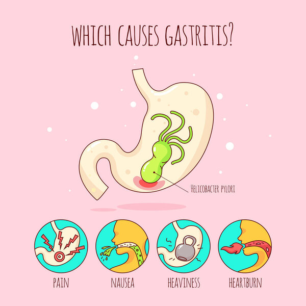 Human stomach and Helicobacter pylori, stomach ache, gastric ulcer.  Placard, poster. Flat Vector Illustration