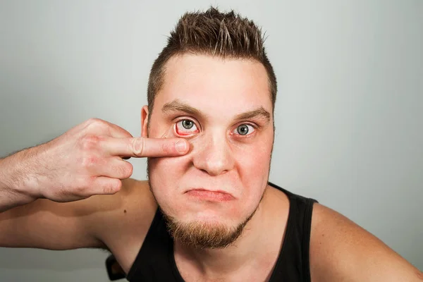 Ein depressiver Typ nach einer Party blickt auf sein rotes Auge und zeichnet mit dem Mittelfinger vor einem Spiegel ein Augenlid auf grauem Hintergrund — Stockfoto