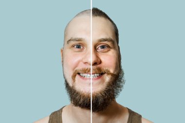 Saç dökülmesinden önce ve sonra mutlu adam, arka planda saç dökülmesi.