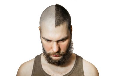 Saç dökülmesinden önce ve sonra, izole edilmiş arka planda organ nakli.