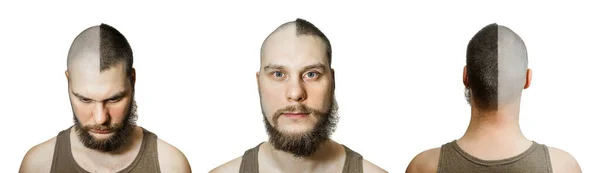 Halb geschnittene Glatze auf isoliertem Hintergrund. Mann hält Kamm und Haarschneidemaschine. Konzept von Haarausfall, Alopezie, Transplantation — Stockfoto