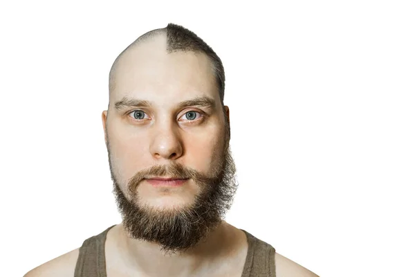 Hombre antes y después de la pérdida de cabello, trasplante en un fondo aislado —  Fotos de Stock