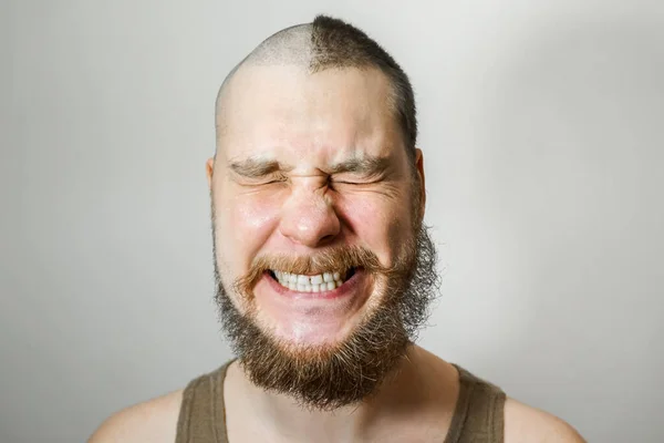 Happy or screaming Homem antes e depois da perda de cabelo, alopecia em fundo isolado — Fotografia de Stock