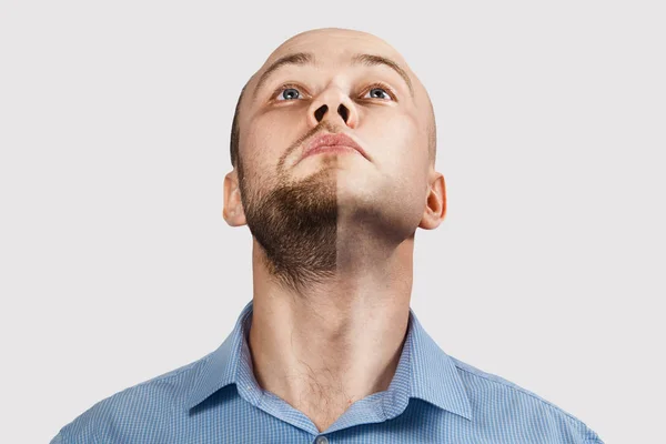 Queixo Homem antes e depois de tratamento de perda de cabelo no fundo branco — Fotografia de Stock