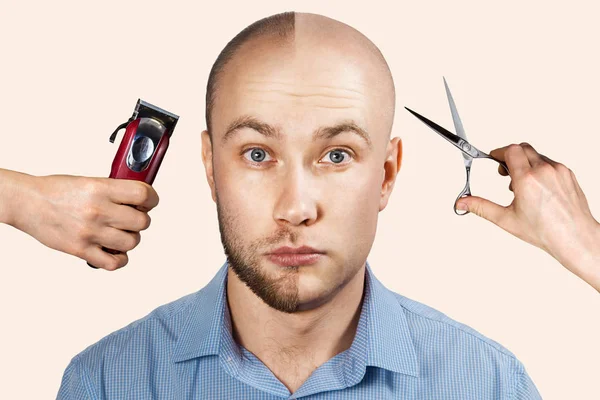 Saç dökülmesinden önce ve sonra bir adam, arka planda saç dökülmesi, traş makinesi ve makaslı eller. — Stok fotoğraf