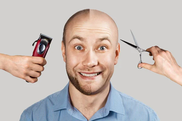 Man before and after hair loss, alopecia on background with hands that derat shaving machine and scissors — 스톡 사진