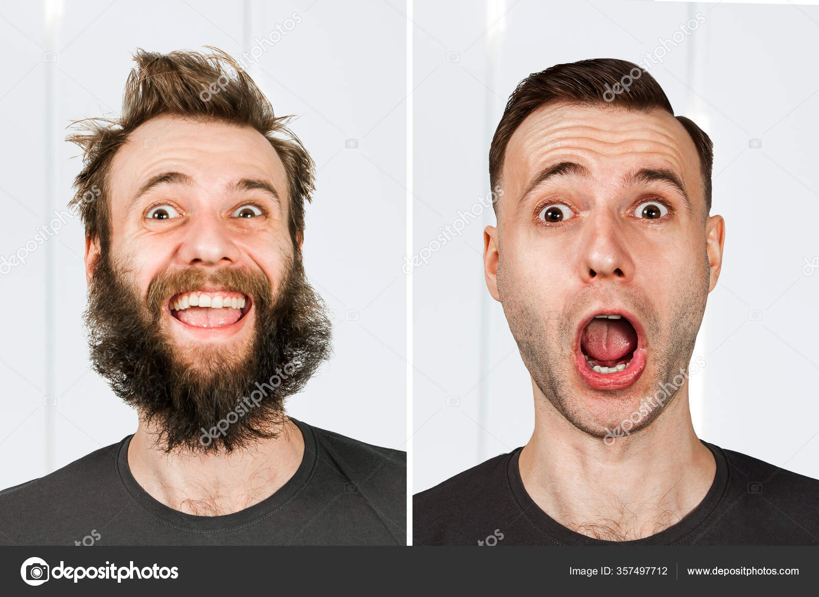 Happy Guy Beard Hair Loss Man Shave Transplant Haircut Set Stock Photo