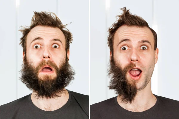 有半个胡子 没有脱发的家伙 男人在刮胡子或移植之前和之后 发型机转换 — 图库照片