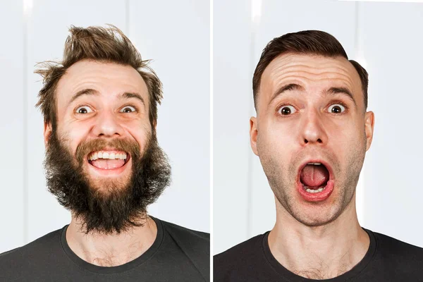 Happy Guy Beard Hair Loss Man Shave Transplant Haircut Set — Stock Photo, Image
