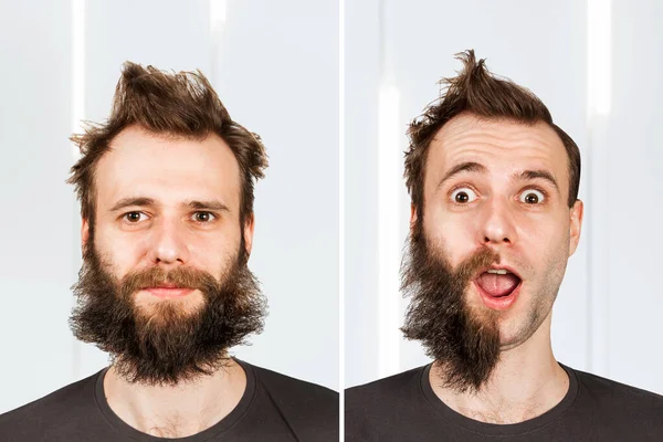 Cara Com Meia Barba Sem Perda Cabelo Homem Antes Depois — Fotografia de Stock
