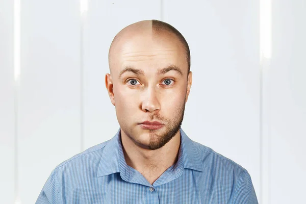 Portrét Muž Před Vypadávání Vlasů Transplantace Rozdělit Osobnost — Stock fotografie