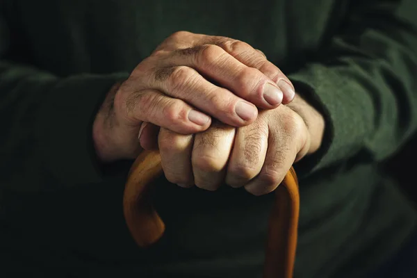 Gnarled arthritic fingers of an old man — Stock Photo, Image